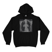 Load image into Gallery viewer, "X-Ray" Basic Hoodie Black/White